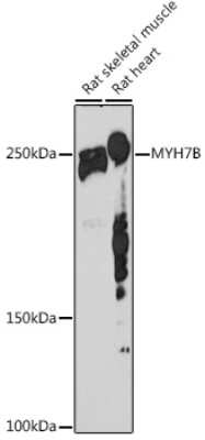 Western Blot: MYH7B Antibody (7W8J3) [NBP3-16495]