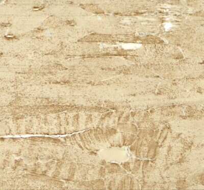 Immunohistochemistry: MYH8 Antibody - BSA Free [NBP2-41309]