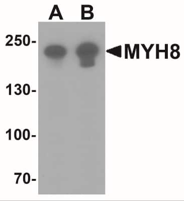 Western Blot: MYH8 AntibodyBSA Free [NBP2-41309]