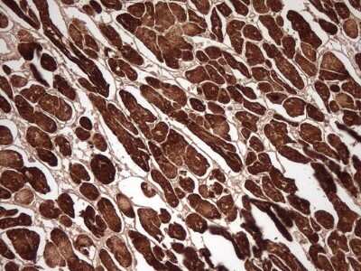 Immunohistochemistry: MYL4 Antibody (OTI1H6) [NBP2-46062]