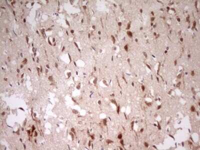 Immunohistochemistry: MYL4 Antibody (OTI1H6) [NBP2-46062]
