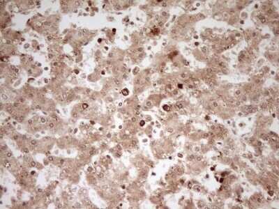 Immunohistochemistry: MYL4 Antibody (OTI1H6) [NBP2-46062]