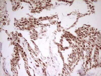 Immunohistochemistry: MYL4 Antibody (OTI1H6) [NBP2-46062]