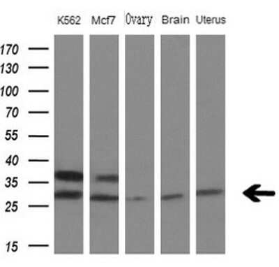 Western Blot: MYL4 Antibody (OTI1H6) [NBP2-46062]