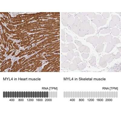 Immunohistochemistry-Paraffin: MYL4 Antibody [NBP2-30954]