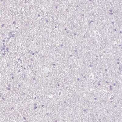 Immunohistochemistry-Paraffin: MYL4 Antibody [NBP2-30954]