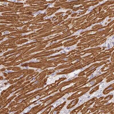 Immunohistochemistry-Paraffin: MYL4 Antibody [NBP2-30954]