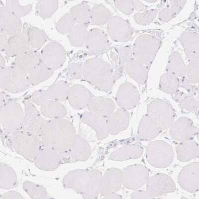 Immunohistochemistry-Paraffin: MYL4 Antibody [NBP2-30954]