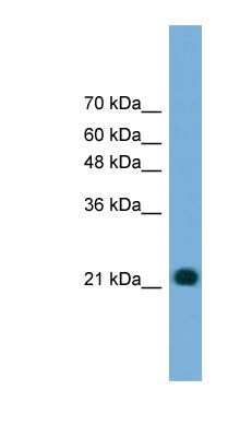 Western Blot: MYL4 Antibody [NBP1-79617]