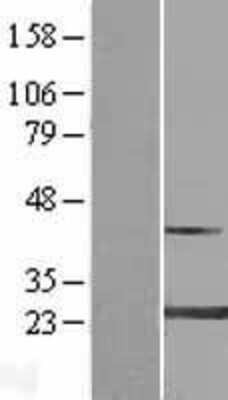 Western Blot: MYL4 Overexpression Lysate [NBL1-13426]