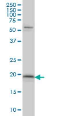 Western Blot: MYL5 Antibody (3D12) [H00004636-M03]