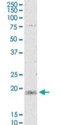 Western Blot: MYL5 Antibody (3D12) [H00004636-M03]