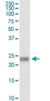 Western Blot: MYL5 Antibody (3D12) [H00004636-M03]