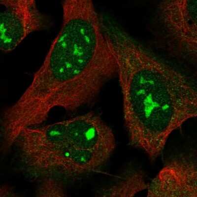 Immunocytochemistry/ Immunofluorescence: MYL5 Antibody [NBP1-86279]