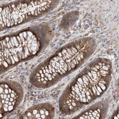 Immunohistochemistry-Paraffin: MYL5 Antibody [NBP1-86279]