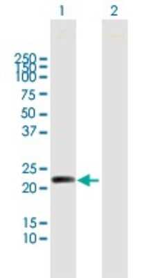 Western Blot: MYL5 Antibody [H00004636-B01P]