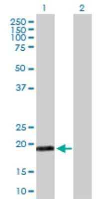 Western Blot: MYL5 Antibody [H00004636-D01P]