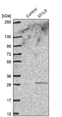 Western Blot: MYL5 Antibody [NBP1-86279]