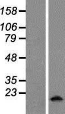 Western Blot: MYL5 Overexpression Lysate [NBP2-08112]