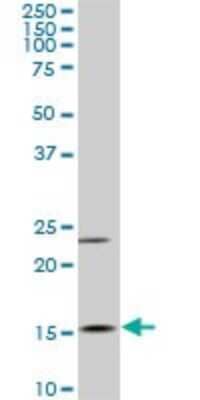 Western Blot: MYL6 Antibody (1D6) [H00004637-M03]