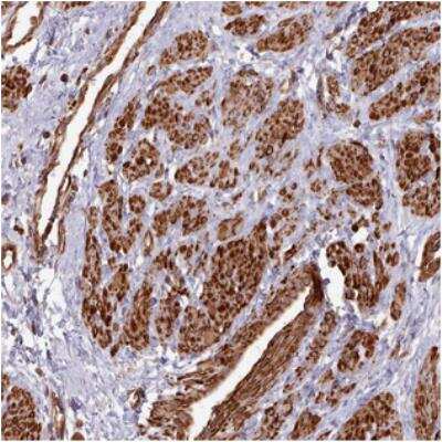 Immunohistochemistry: MYL6 Antibody [NBP2-30441]