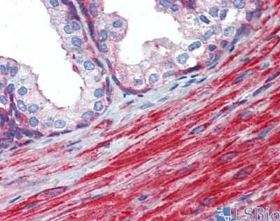 Immunohistochemistry: MYL6 Antibody [NBP3-09356]