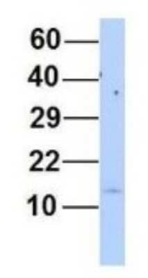 Western Blot: MYL6 Antibody [NBP1-54376]