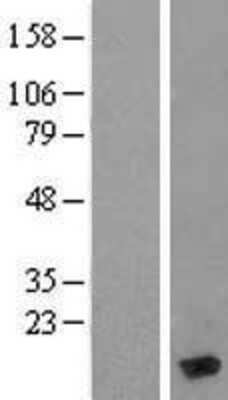 Western Blot: MYL6 Overexpression Lysate [NBL1-13427]