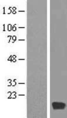 Western Blot: MYL6 Overexpression Lysate [NBP2-05791]