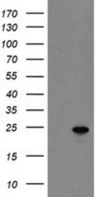 Western Blot: MYL7 Antibody (OTI4E7) [NBP2-03891]