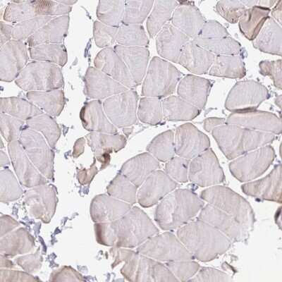 Immunohistochemistry-Paraffin: MYL7 Antibody [NBP1-81016]