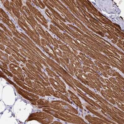 Immunohistochemistry-Paraffin: MYL7 Antibody [NBP1-81016]