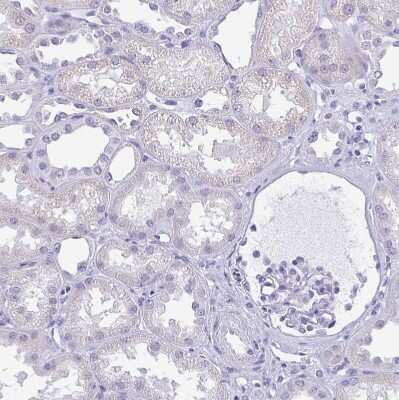 Immunohistochemistry-Paraffin: MYL7 Antibody [NBP1-81016]
