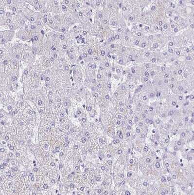 Immunohistochemistry-Paraffin: MYL7 Antibody [NBP1-81016]