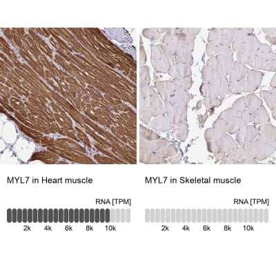 Immunohistochemistry-Paraffin: MYL7 Antibody [NBP1-81016]