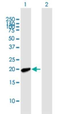 Western Blot: MYL7 Antibody [H00058498-B01P]