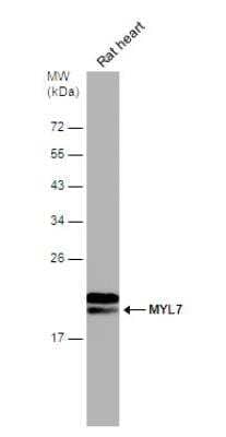 Western Blot: MYL7 Antibody [NBP2-19449]