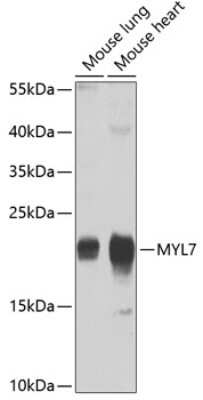 Western Blot: MYL7 AntibodyBSA Free [NBP2-93350]