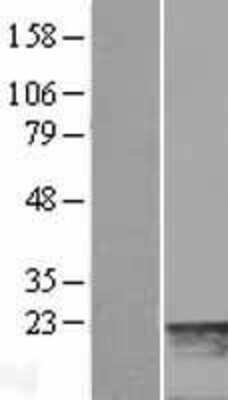 Western Blot: MYL7 Overexpression Lysate [NBL1-13429]