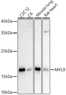 Western Blot: MYL9 AntibodyAzide and BSA Free [NBP2-94899]