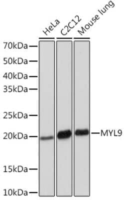 Western Blot: MYL9 Antibody (4C9E8) [NBP3-16691]