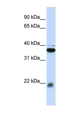 Western Blot: MYL9 Antibody [NBP1-55383]