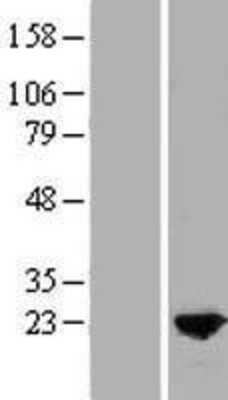 Western Blot: MYL9 Overexpression Lysate [NBP2-07665]