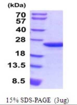 SDS-PAGE: Recombinant Mouse MYL9 His Protein [NBP2-52080]