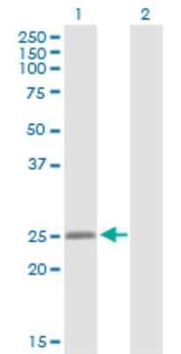 Western Blot: MYLC2PL Antibody [H00093408-D01P]