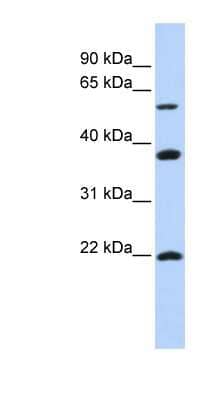 Western Blot: MYLIP Antibody [NBP1-54903]