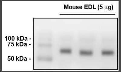 Western Blot: MYLK2 Antibody (2G1) [H00085366-M01]