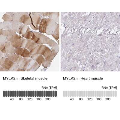 Immunohistochemistry-Paraffin: MYLK2 Antibody [NBP2-32489]