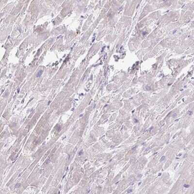 Immunohistochemistry-Paraffin: MYLK2 Antibody [NBP2-32497]