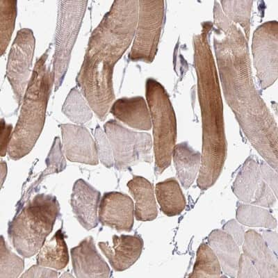 Immunohistochemistry-Paraffin: MYLK2 Antibody [NBP2-32497]